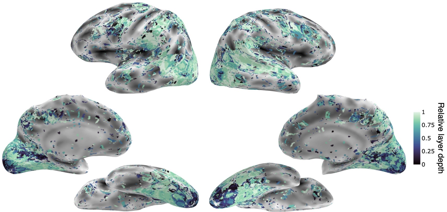 Whole-brain hierarchical alignment