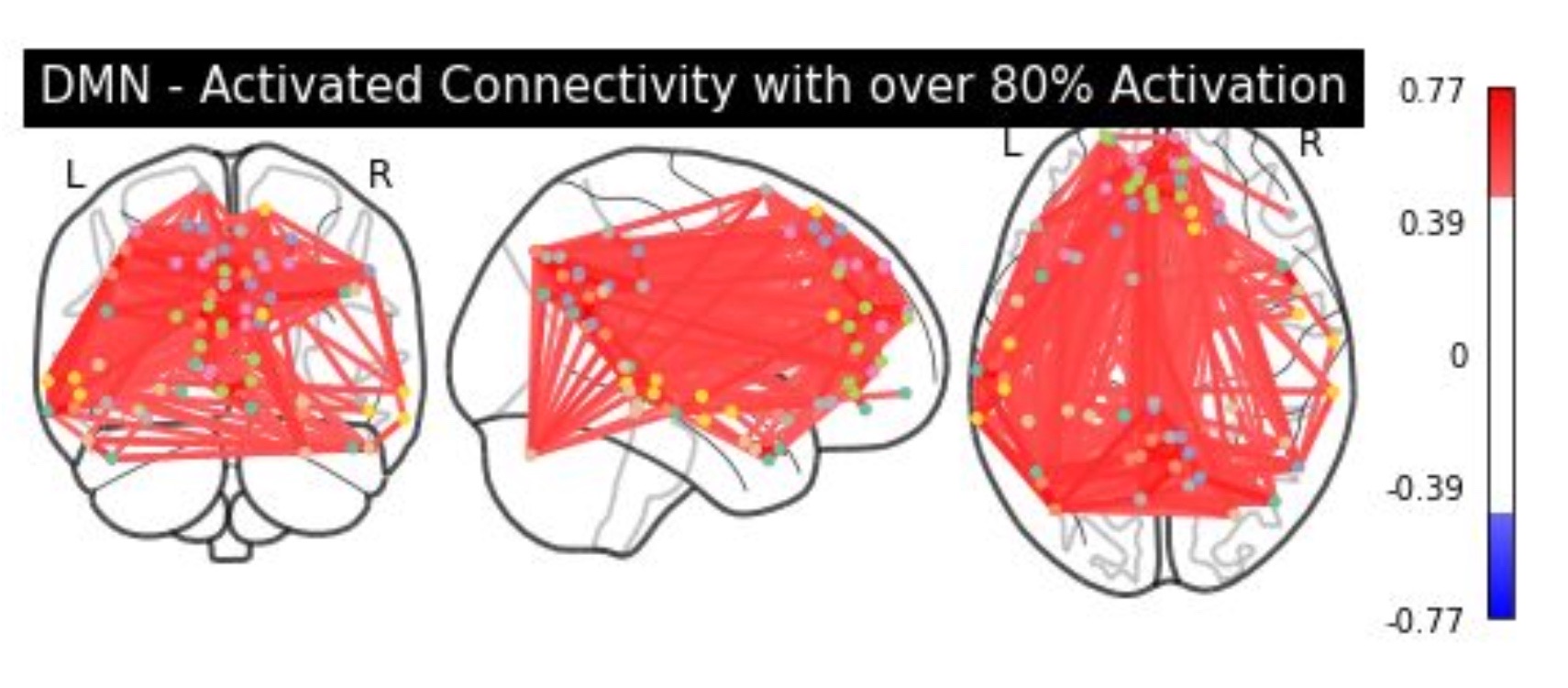 Candidate brain networks for future analyses